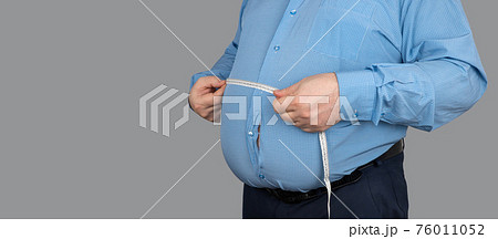 fat guy measures the size of the abdomen with a centimeter measuring tape.  76011052