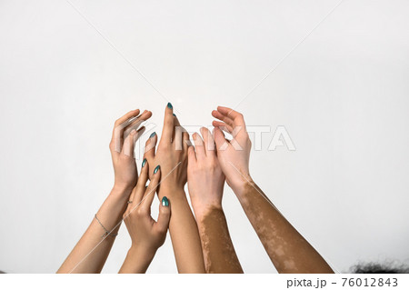 Diverse feminist motivated girls putting their hands together Diverse feminist motivated girls putting their hands together 76012843