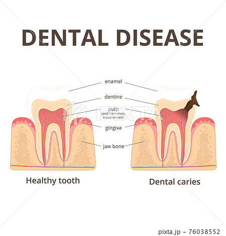 structure of human teeth structure of human teeth 76038552