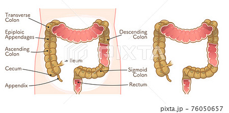 colon illustration(sectional view) colon illustration(sectional view) 76050657