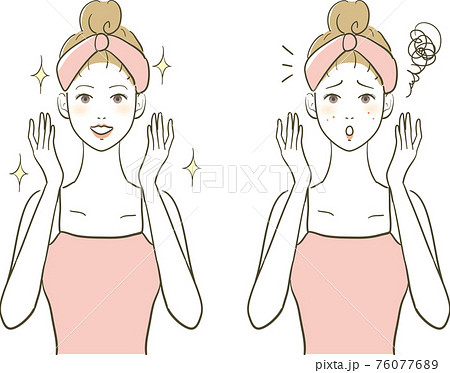 美容きれいな女性とニキビの女性 美容きれいな女性とニキビの女性 76077689