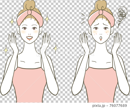 美容きれいな女性とニキビの女性 美容きれいな女性とニキビの女性 76077689