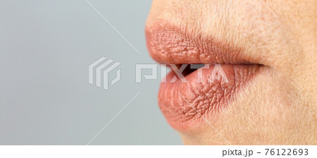 Women's lips are stretched out into a tube like a duck 76122693