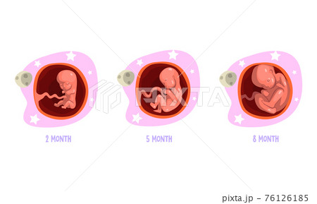 Stages of Embryo Development Set, 2, 5, 8 Month Cartoon Vector Illustration 76126185