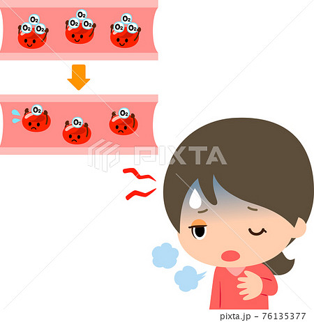 貧血の女性と酸素運搬量が減った赤血球のイラスト素材