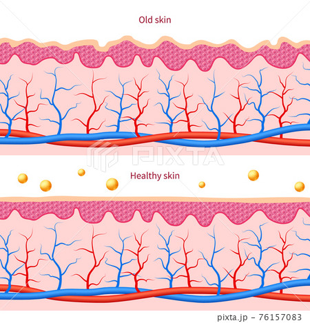 Collagen human skin effect. Close up damaged old and healthy medical care cosmetic diagrams 76157083