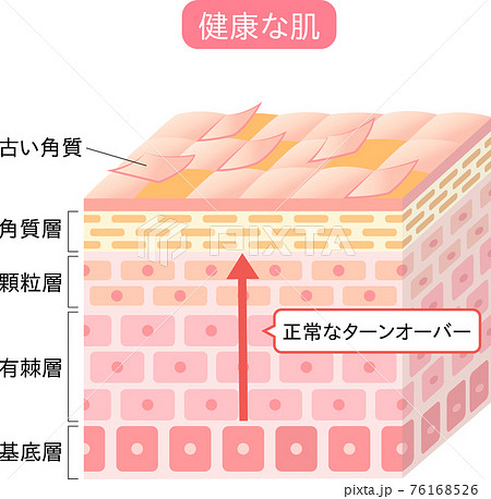 ターンオーバー 断面図 立体 ターンオーバー 断面図 立体 76168526