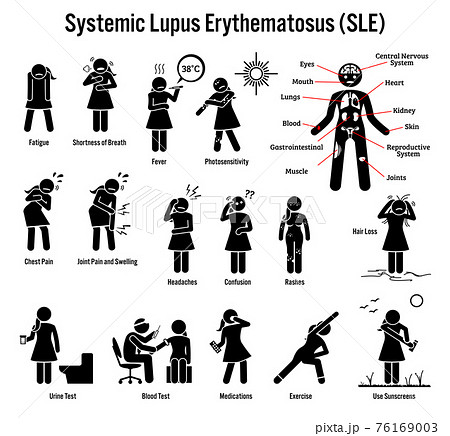 Systemic Lupus Erythematosus SLE Autoimmune Disease Icons. Pictogram depicts signs, symptoms, diagnosis, and treatment of lupus SLE disease. 76169003