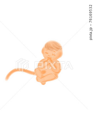 Image illustration of a foetation in the... - Stock Illustration [76169532]  - PIXTA