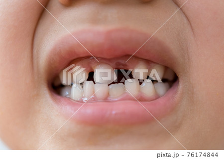 7 years old 76174844