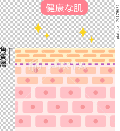 健康な肌　断面図 76179675