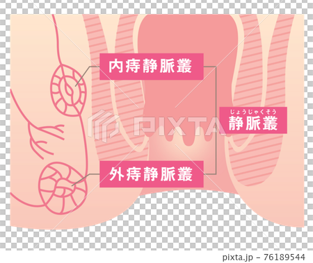 肛門の構造のイラスト 76189544