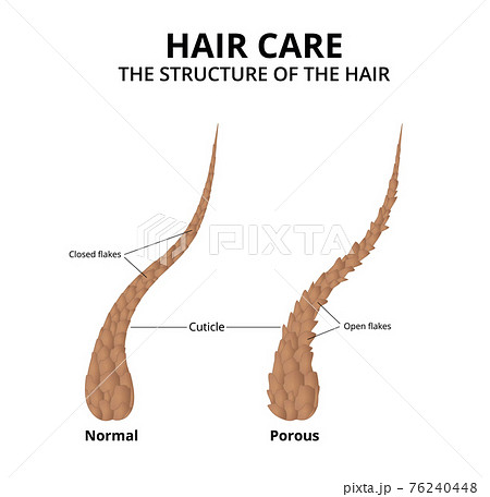 Cuticle of hair close-up 76240448