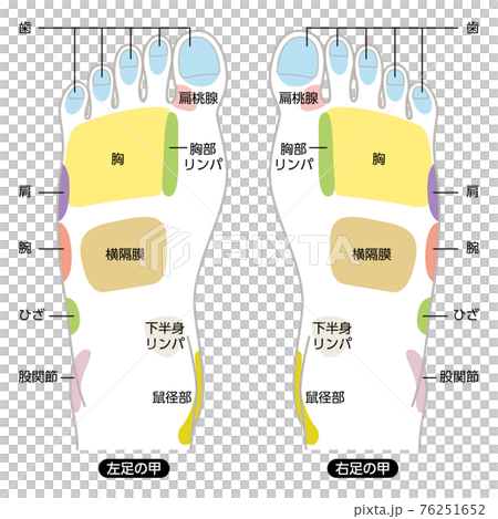 腳鍋名圖 76251652