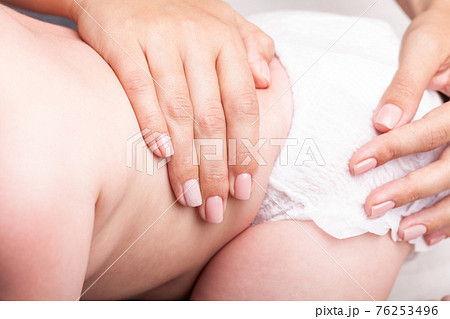 Little baby receiving osteopathic treatment of her pelvis Little baby receiving osteopathic treatment of her pelvis 76253496