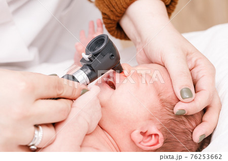 Newborn ENT exam - doctor checking nose with otoscope in pediatric clinic Newborn ENT exam - doctor checking nose with otoscope in pediatric clinic 76253662