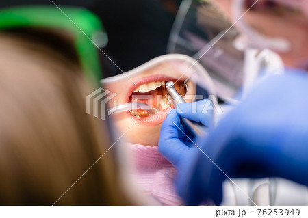 Preteen girl receiving teeth cleaning procedure in pediatric dental clinic Preteen girl receiving teeth cleaning procedure in pediatric dental clinic 76253949