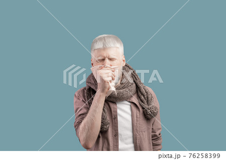 Seasonal flu. Sick albino guy blowing his nose into paper napkin, standing over studio background Seasonal flu. Sick albino guy blowing his nose into paper napkin, standing over studio background 76258399