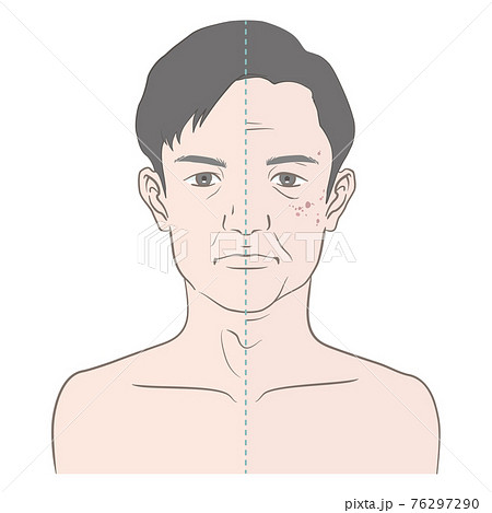40代 中年男性の経年変化 ビフォーアフターのイラスト素材