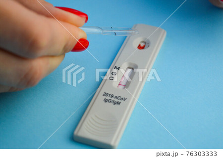 test for coronavirus on a blue background. girl with a bright red manicure makes a blood test. a small test tube drips a physical solution onto a test strip with a drop of blood 76303333