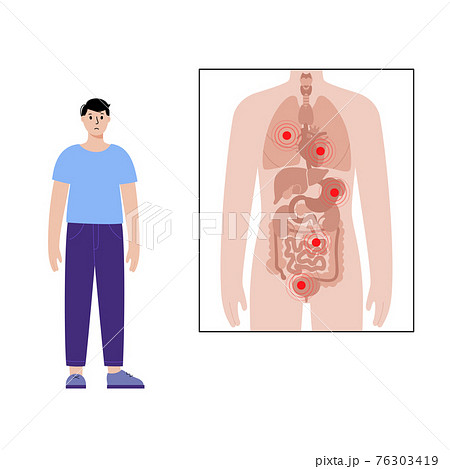 Pain in male body 76303419