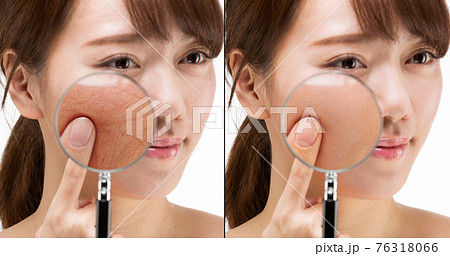 肌の比較 76318066