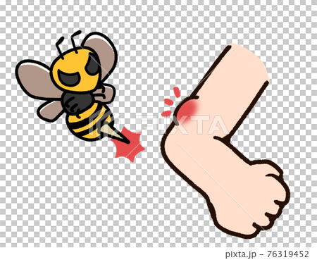 bee sting clipart