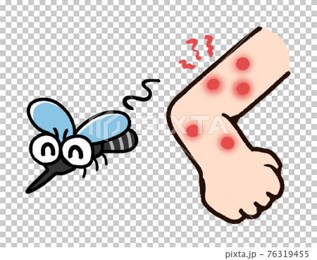 虫刺され 腕 蚊のイラスト素材