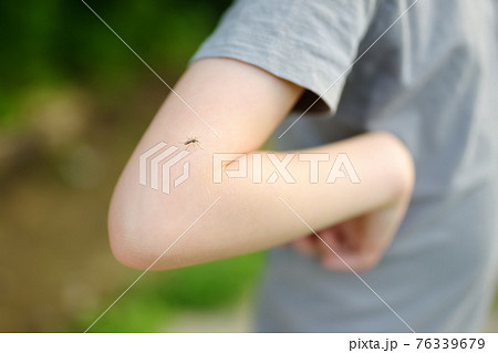 Mosquito sitting on the hand of child. Gnat sucking blood. Danger of bite of an insect. Use repellent for safety kids. 76339679