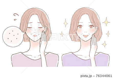 黒ずみ毛穴に悩む中年女性のビフォーアフター 黒ずみ毛穴に悩む中年女性のビフォーアフター 76344061