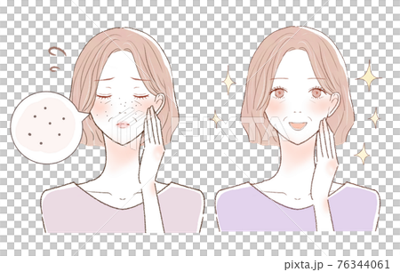 黒ずみ毛穴に悩む中年女性のビフォーアフター 黒ずみ毛穴に悩む中年女性のビフォーアフター 76344061