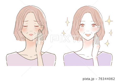 日焼けした中年女性のビフォーアフター 76344062