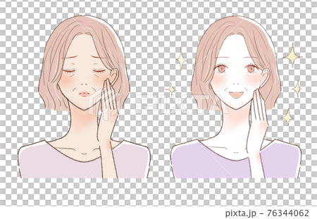 日焼けした中年女性のビフォーアフター 76344062