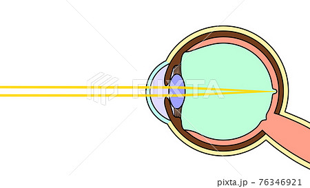 光と眼球の断面図 イメージ図 のイラスト素材