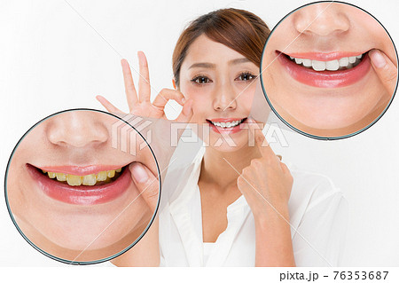 デンタルケア. デンタルケア. 76353687
