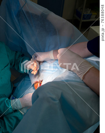 A surgical instrument in the bloodied hands of surgeons during a surgical operation. A surgical instrument in the bloodied hands of surgeons during a surgical operation. 76388048