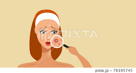 woman having facial skin problems girl using magnifier to find acne on face area portrait horizontal 76395745