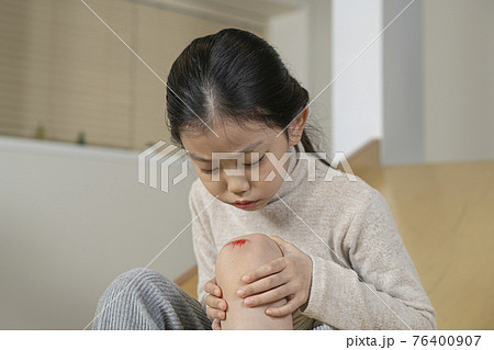 Asian little girl with wound on knee due to slide 76400907