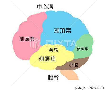 脳　カラー　名称　線無し 76421301