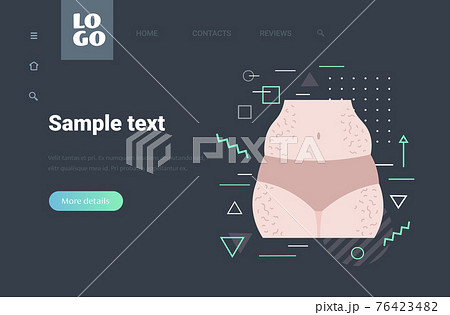 cellulite problem zones of female body weight loss fat diet concept copy space horizontal 76423482