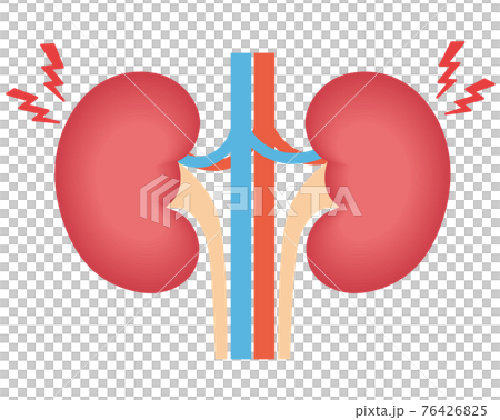 腎泌尿系統發炎 76426825