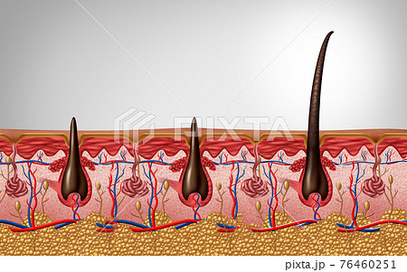 Hair Follicle 76460251