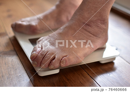 体重を計るシニア女性 体重を計るシニア女性 76460666