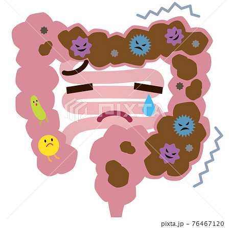 便秘の大腸 腸内環境 悪玉菌のイラスト素材