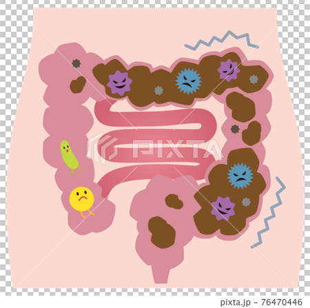Constipation large intestine intestinal environment bad bacteria 76470446
