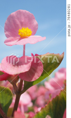 Begonia flowers and blue sky in Hokkaido Furano province of Japan. Flowers and sunny day in August which is summer season of Japan. low angle view. close up shot. Begonia in Hokkaido. Begonia flowers and blue sky in Hokkaido Furano province of Japan. Flowers and sunny day in August which is summer season of Japan. low angle view. close up shot. Begonia in Hokkaido. 76480281