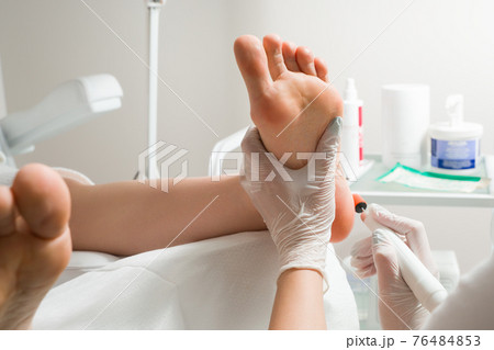 Podiatrist doctor, performs the procedure of treating a woman's legs. Cosmetic procedures of the feet 76484853