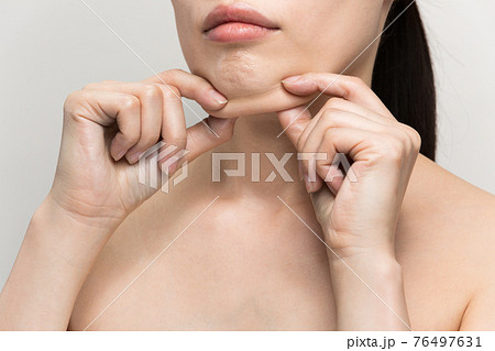 あごの脂肪を掴む女性 76497631