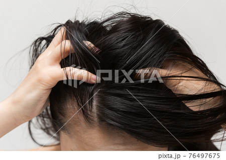 頭皮ケア 76497675