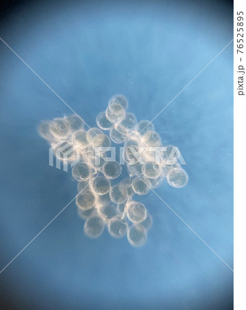 メダカの卵 孵化までの観察 4日目 メダカの卵 孵化までの観察 4日目 76525895